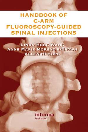 The Handbook of C-Arm Fluoroscopy-Guided Spinal Injections de Linda Hong Wang