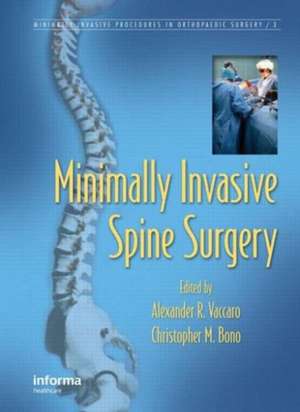 Minimally Invasive Spine Surgery de Alexander R. Vaccaro