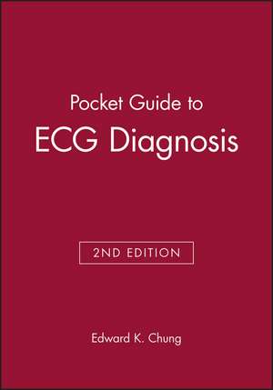 Pocket Guide to ECG Diagnosis de Chung