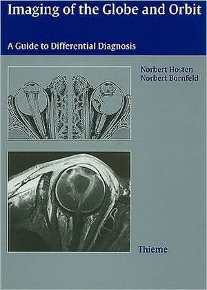 Imaging of the Globe and Orbit: A Guide to Differential Diagnosis de Norbert Hosten