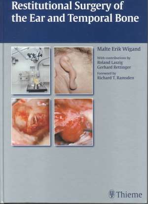 Restitutional Surgery of the Ear and Temporal Bone de Malte Erik Wigand