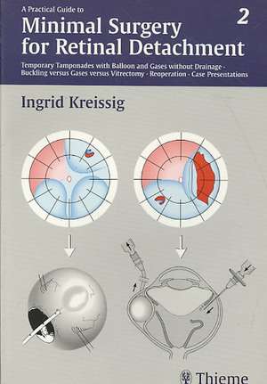 A Practical Guide to Minimal Surgery for Retinal Detachment, Volume II de Ingrid Kreissig