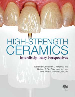 High-Strength Ceramics: Interdisciplinary Perspectives de Jonathan L. Ferencz