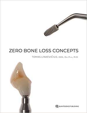 Linkevicius, T: Zero Bone Loss Concepts de Tomas Linkevicius