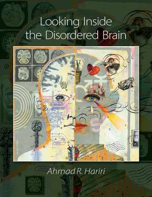 Looking Inside the Disordered Brain de Ahmad R. Hariri