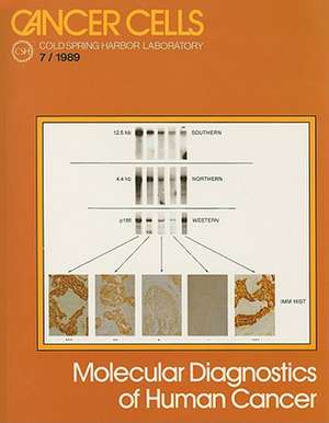 Molecular Diagnostics of Human Cancer de Mark Furth