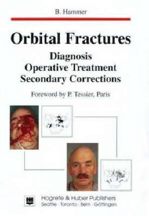 Orbital Fractures de Beat Hammer