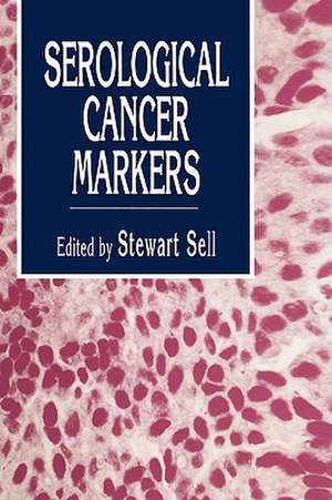 Serological Cancer Markers de Stewart Sell