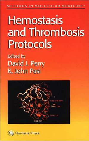 Hemostasis and Thrombosis Protocols de David J. Perry