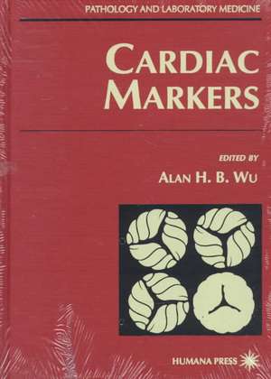 Cardiac Markers de Alan H. B. Wu