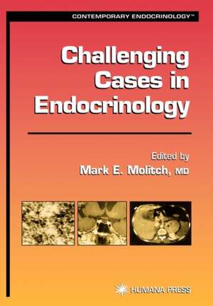 Challenging Cases in Endocrinology de Mark E. Molitch