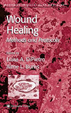 Wound Healing: Methods and Protocols de Luisa A. DiPietro