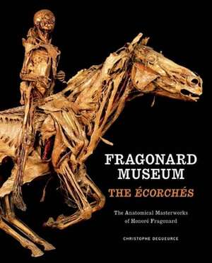 Fragonard Museum: The Ecorches de Christophe Degueurce