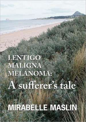 Lentigo Maligna Melanoma: A Sufferer's Tale de Mirabelle Maslin