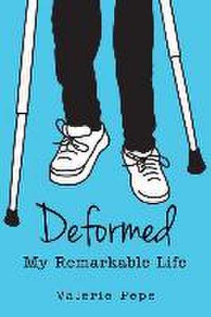 Deformed: My Remarkable Life de Valerie Pepe