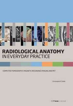 Radiological Anatomy in Everyday Practice: Computed Tomography, Magnetic Resonance Imaging and PET de Christophe R. Chelle