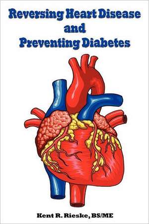 Reversing Heart Disease and Preventing Diabetes de Kent R. Rieske