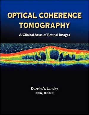 Optical Coherence Tomography a Clinical Atlas of Retinal Images de Darrin A. Landry