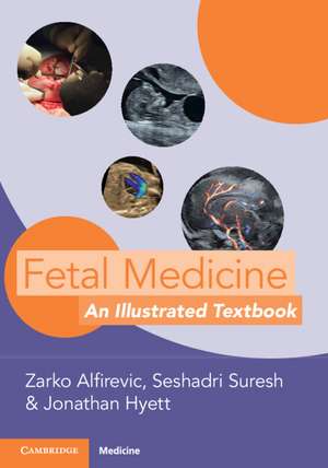 Fetal Medicine: An Illustrated Textbook de Zarko Alfirevic