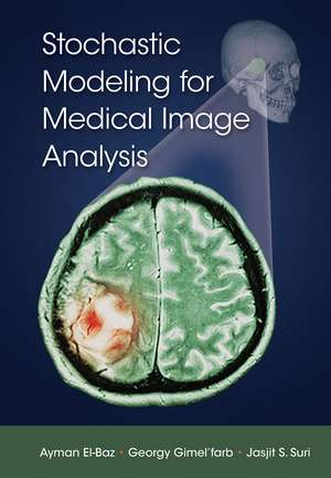 Stochastic Modeling for Medical Image Analysis de Ayman El-Baz