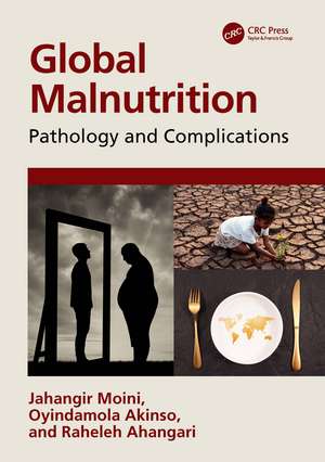 Global Malnutrition: Pathology and Complications de Jahangir Moini