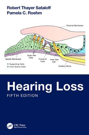 Hearing Loss de Robert Thayer Sataloff