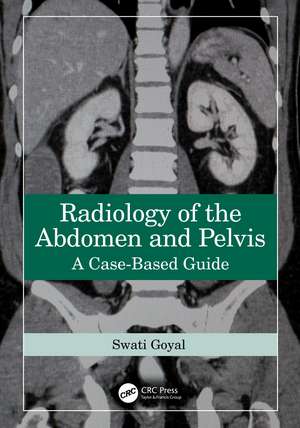 Radiology of the Abdomen and Pelvis: A Case-Based Guide de Swati Goyal