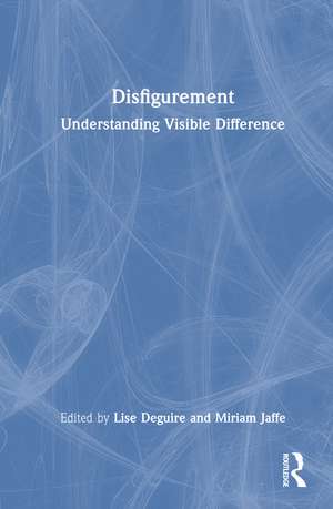 Disfigurement: Understanding Visible Difference de Lise Deguire