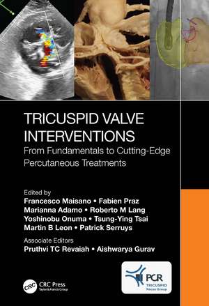 Tricuspid Valve Interventions: From Fundamentals to Cutting-Edge Percutaneous Treatments de Francesco Maisano