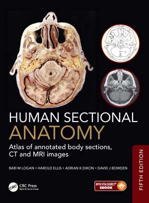 Human Sectional Anatomy: Atlas of annotated body sections, CT and MRI images de Bari M. Logan