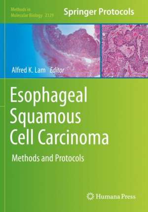 Esophageal Squamous Cell Carcinoma: Methods and Protocols de Alfred K. Lam