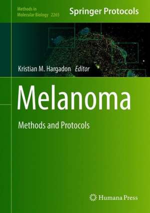 Melanoma: Methods and Protocols de Kristian M. Hargadon