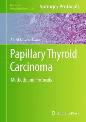 Papillary Thyroid Carcinoma: Methods and Protocols de Alfred K. Lam