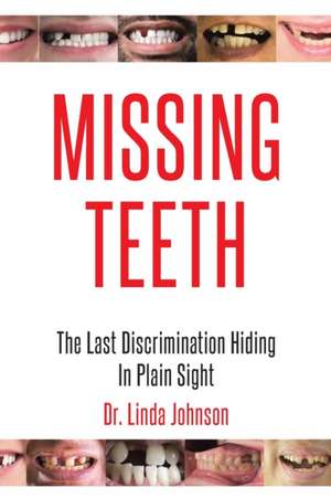 Missing Teeth de Linda Johnson