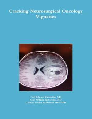 Cracking Neurosurgical Oncology Vignettes de Paul Edward Kaloostian MD