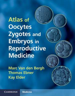 Atlas of Oocytes, Zygotes and Embryos in Reproductive Medicine Hardback with CD-ROM de Marc Van den Bergh