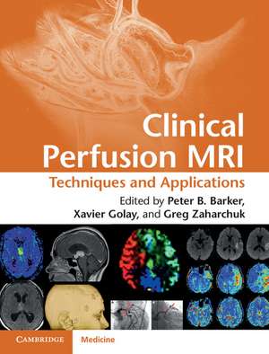 Clinical Perfusion MRI: Techniques and Applications de Peter B. Barker