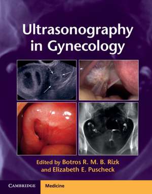 Ultrasonography in Gynecology alte