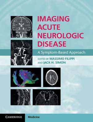 Imaging Acute Neurologic Disease: A Symptom-Based Approach de Massimo Filippi