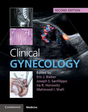 Clinical Gynecology books-express.ro