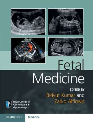 Fetal Medicine de Bidyut Kumar