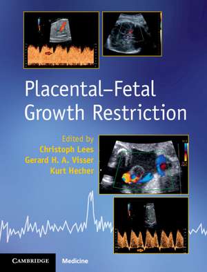 Placental-Fetal Growth Restriction de Christoph Lees