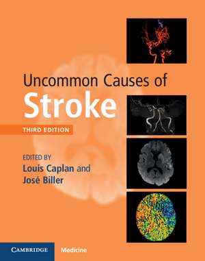 Uncommon Causes of Stroke de Louis Caplan