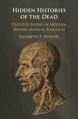 Hidden Histories of the Dead: Disputed Bodies in Modern British Medical Research de Elizabeth T. Hurren