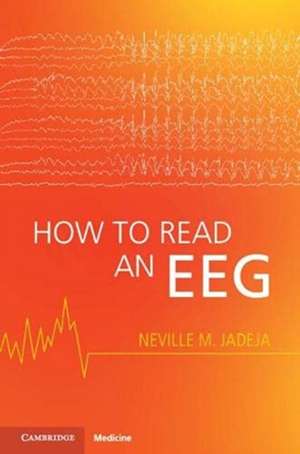 How to Read an EEG de Neville M. Jadeja