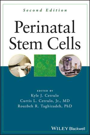 Perinatal Stem Cells de Kyle Cetrulo