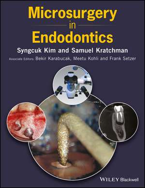 Microsurgery in Endodontics de Skim