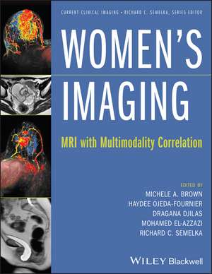 Women′s Imaging – MRI with Multimodality Correlation de MA Brown