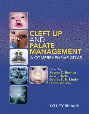 Cleft Lip and Palate Management – A Comprehensive Atlas de RD Bennun