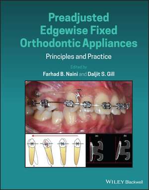 Preadjusted Edgewise Fixed Orthodontic Appliances – Principles and Practice de FB Naini